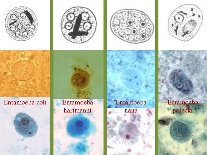 Entamoeba coli Entamoeba nana Entamoeba polecki