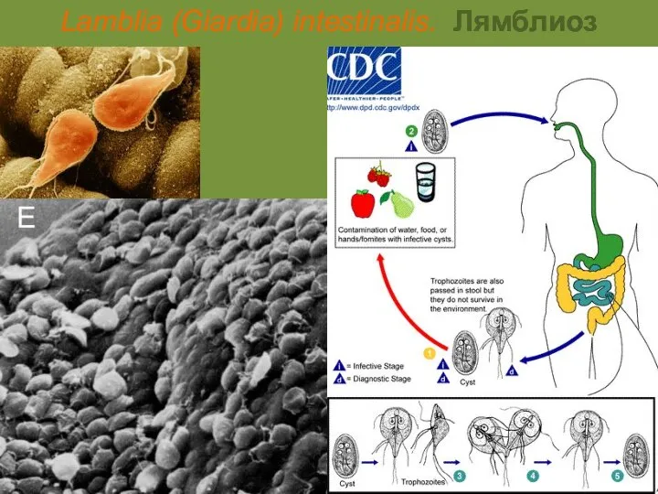 Lamblia (Giardia) intestinalis. Лямблиоз