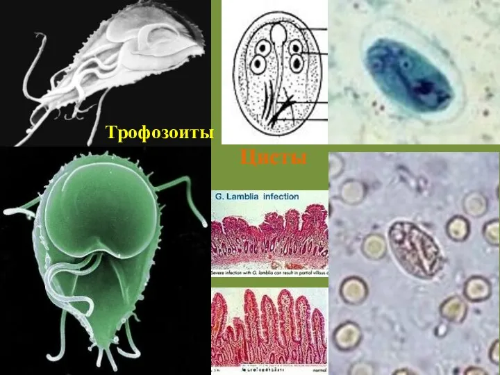 Цисты Трофозоиты