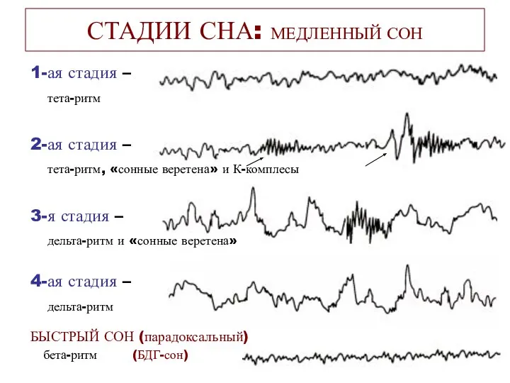 СТАДИИ СНА: МЕДЛЕННЫЙ СОН 1-ая стадия – тета-ритм 2-ая стадия –