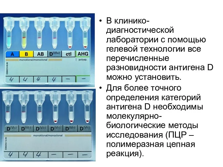 В клинико-диагностической лаборатории с помощью гелевой технологии все перечисленные разновидности антигена