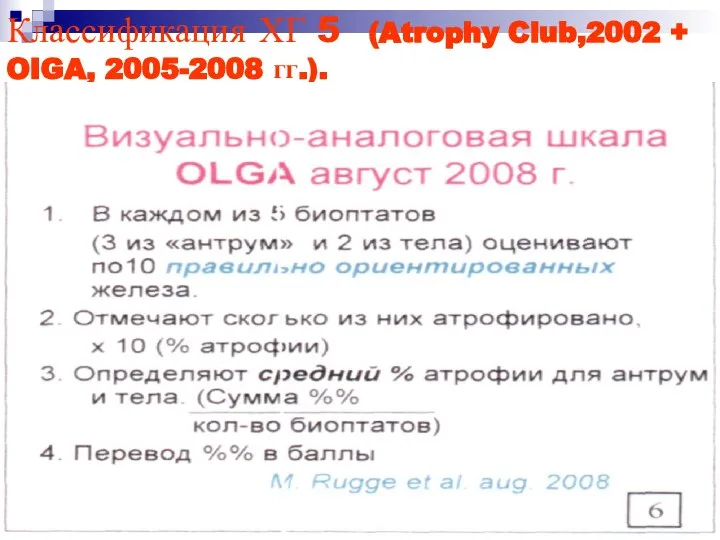 Классификация ХГ 5 (Atrophy Club,2002 + OIGA, 2005-2008 гг.).