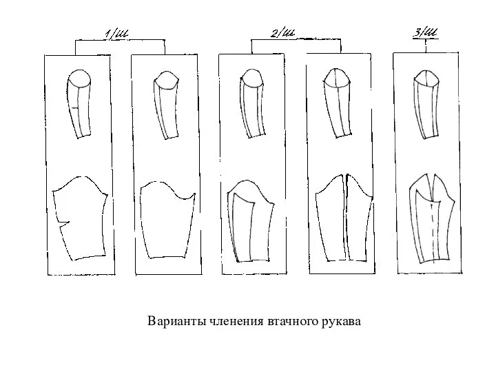 Варианты членения втачного рукава