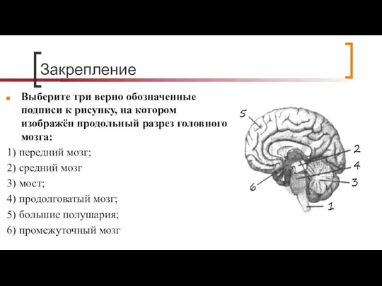 Закрепление Выберите три верно обозначенные подписи к рисунку, на котором изображён