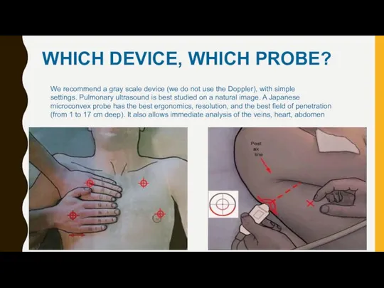 WHICH DEVICE, WHICH PROBE?