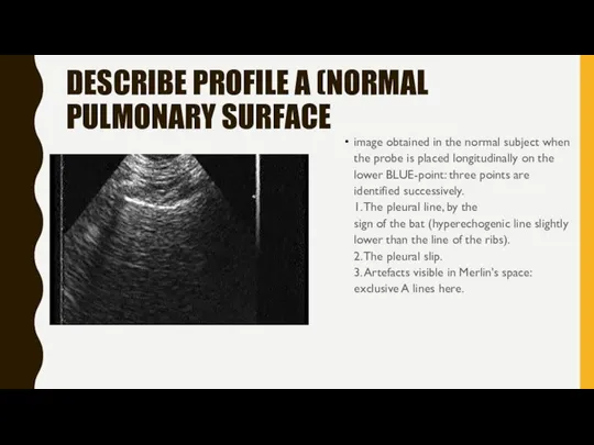 DESCRIBE PROFILE A (NORMAL PULMONARY SURFACE image obtained in the normal