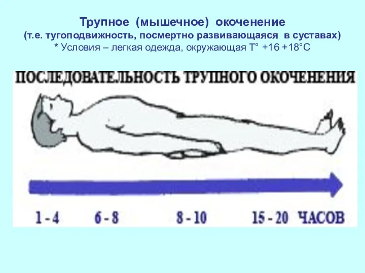 Трупное (мышечное) окоченение (т.е. тугоподвижность, посмертно развивающаяся в суставах) * Условия