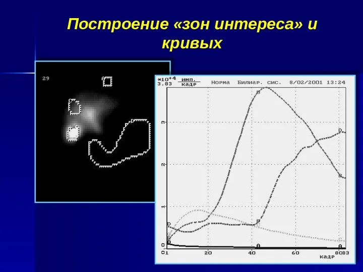 Построение «зон интереса» и кривых