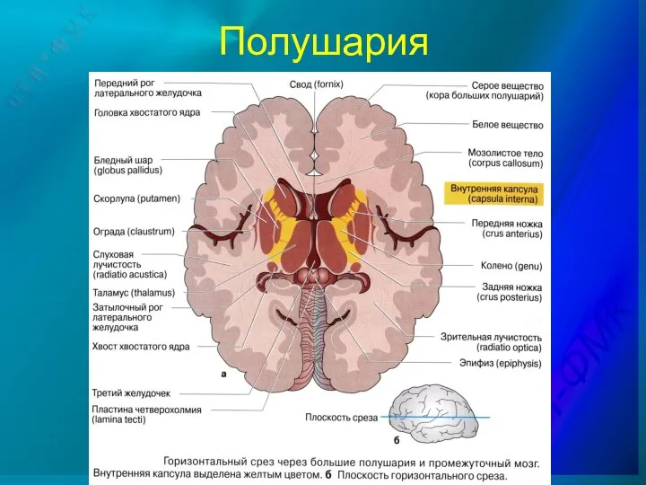 Полушария