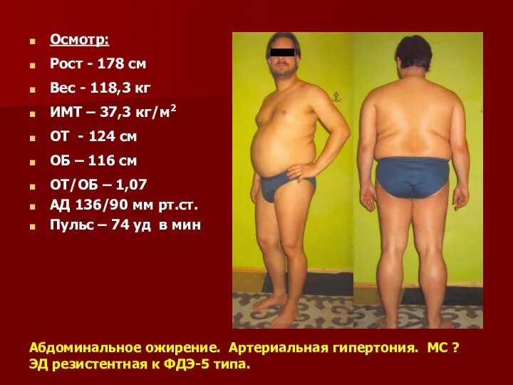 Осмотр: Рост - 178 см Вес - 118,3 кг ИМТ –