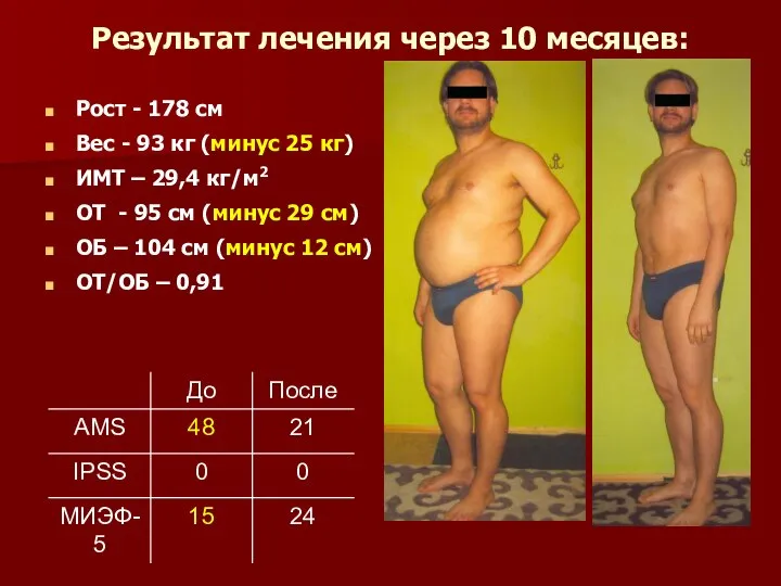 Результат лечения через 10 месяцев: Рост - 178 см Вес -
