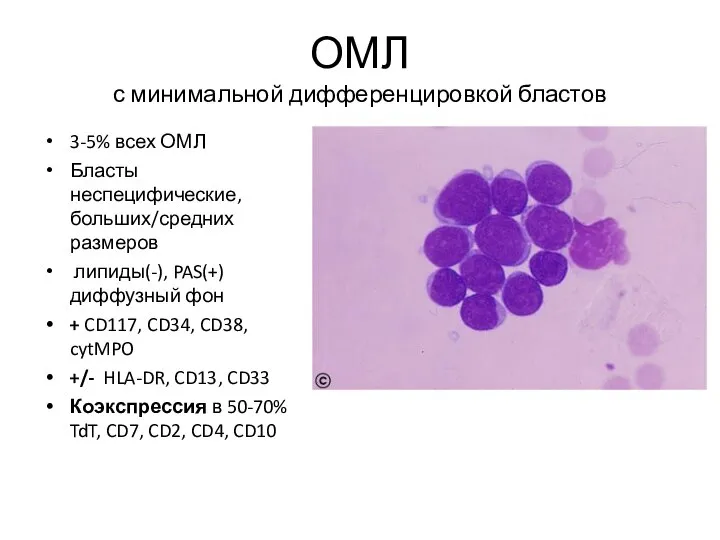 ОМЛ с минимальной дифференцировкой бластов 3-5% всех ОМЛ Бласты неспецифические, больших/средних