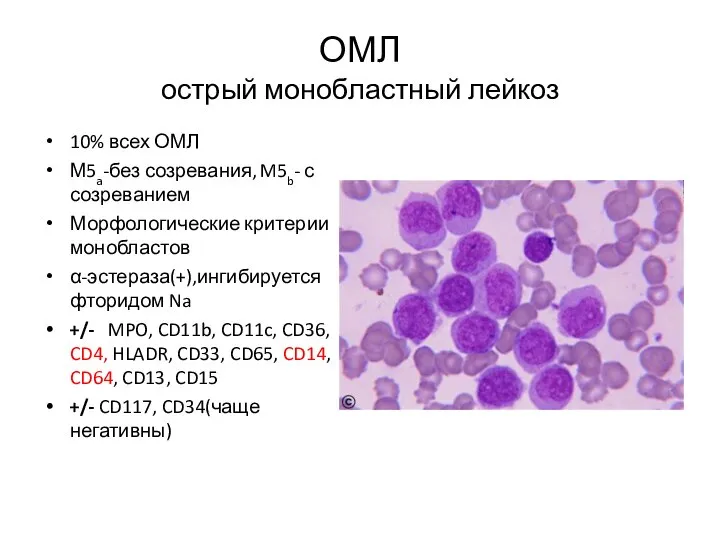 ОМЛ острый монобластный лейкоз 10% всех ОМЛ М5a-без созревания, M5b- с