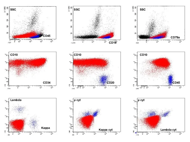 FSC SSC CD19 SSC CD45 SSC TdT CD79a CD10 CD10 CD20