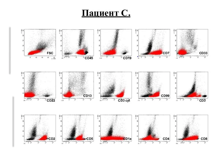 SSC Пациент C. FSC CD19 CD7 CD33 CD22 CD13 CD2 CD5