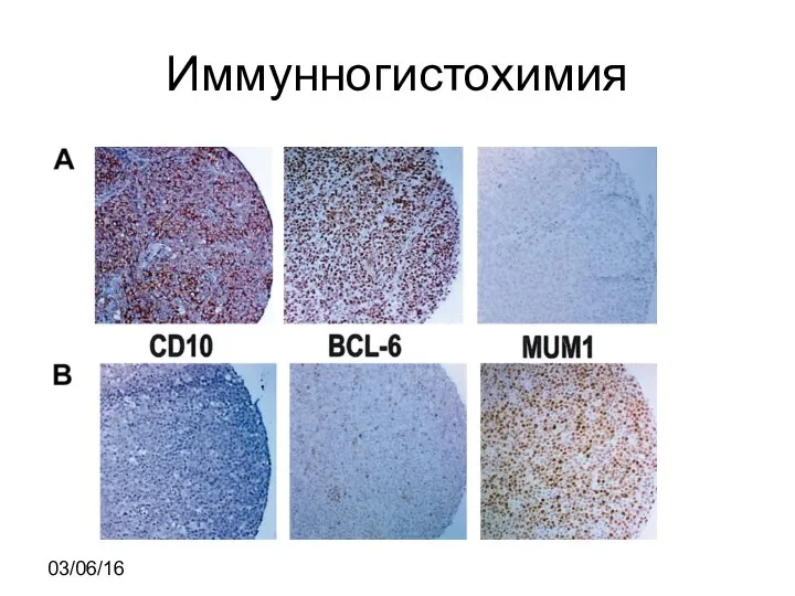 Иммунногистохимия 03/06/16