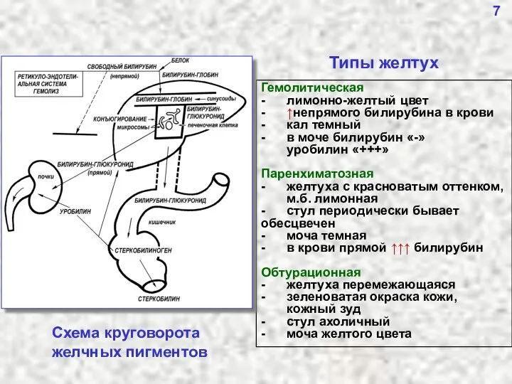 7 Гемолитическая - лимонно-желтый цвет - ↑непрямого билирубина в крови -