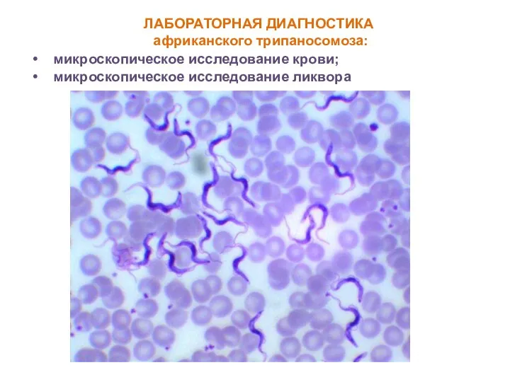 ЛАБОРАТОРНАЯ ДИАГНОСТИКА африканского трипаносомоза: микроскопическое исследование крови; микроскопическое исследование ликвора