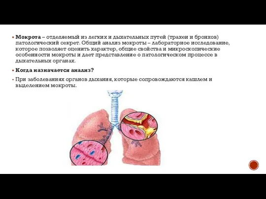 Мокрота – отделяемый из легких и дыхательных путей (трахеи и бронхов)