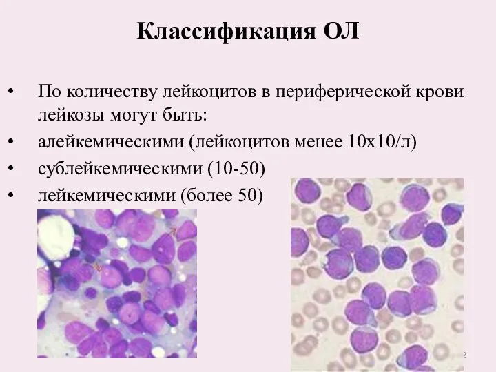 Классификация ОЛ По количеству лейкоцитов в периферической крови лейкозы могут быть: