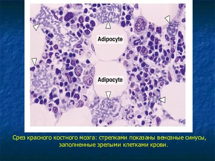 Срез красного костного мозга: стрелками показаны венозные синусы, заполненные зрелыми клетками крови.