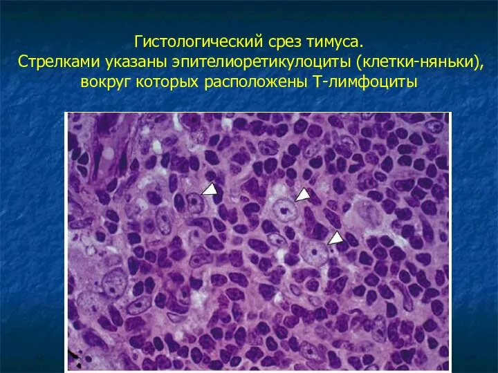 Гистологический срез тимуса. Стрелками указаны эпителиоретикулоциты (клетки-няньки), вокруг которых расположены Т-лимфоциты