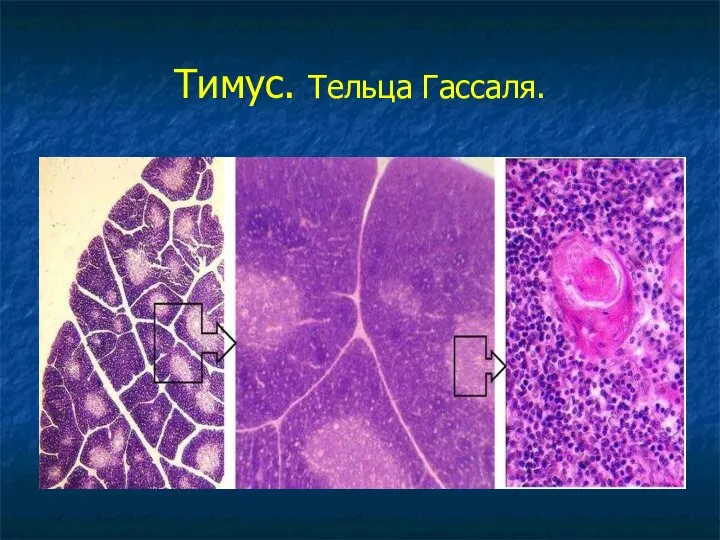 Тимус. Тельца Гассаля.