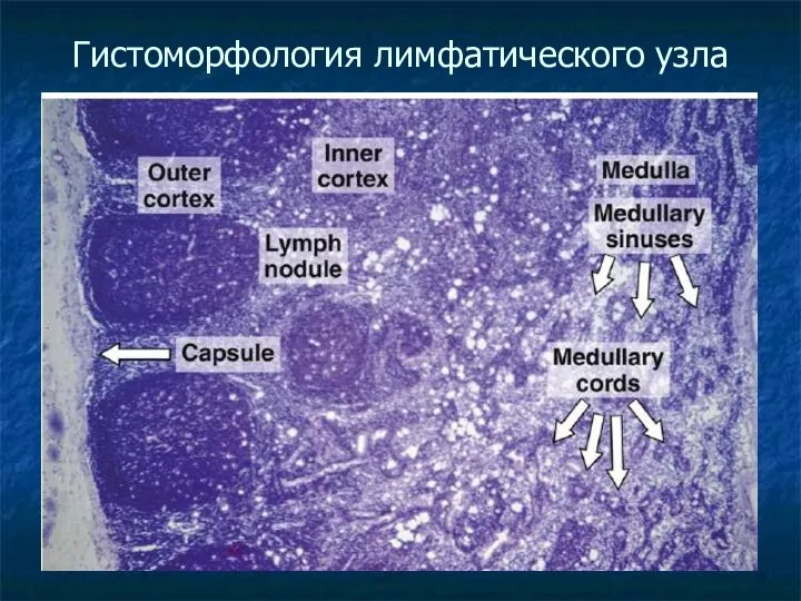 Гистоморфология лимфатического узла