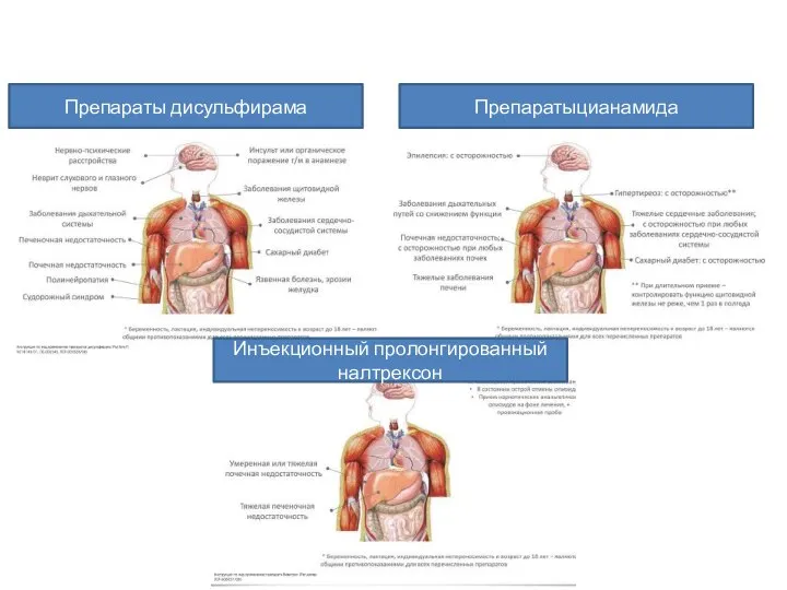 Препараты дисульфирама Препаратыцианамида Инъекционный пролонгированный налтрексон