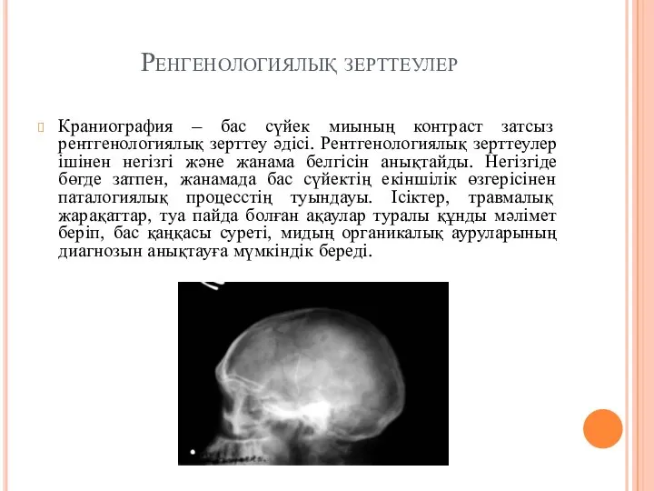 Ренгенологиялық зерттеулер Краниография – бас сүйек миының контраст затсыз рентгенологиялық зерттеу