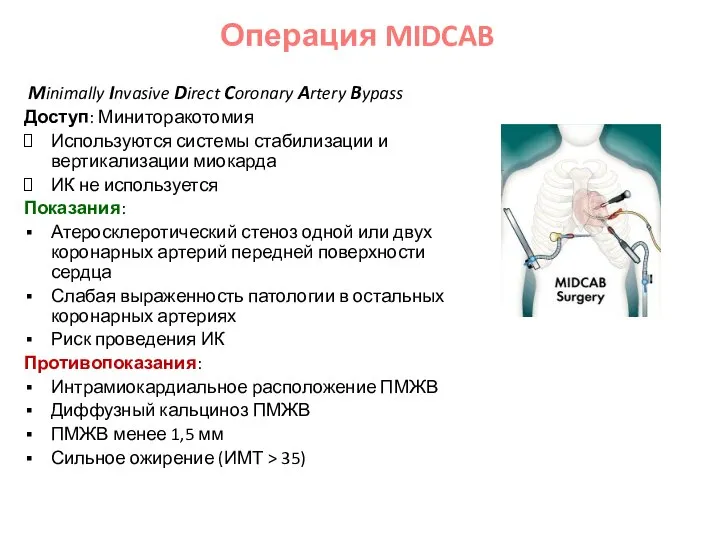 Minimally Invasive Direct Coronary Artery Bypass Доступ: Миниторакотомия Используются системы стабилизации