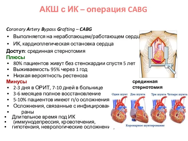 Coronary Artery Bypass Grafting – CABG Выполняется на неработающем/работающем сердце ИК,