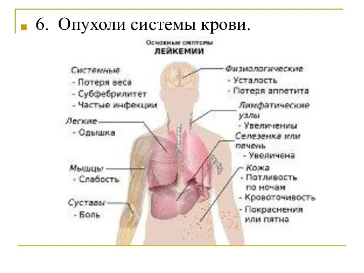 6. Опухоли системы крови.