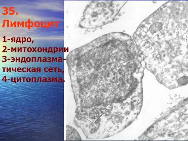 35. Лимфоцит 1-ядро, 2-митохондрии 3-эндоплазма-тическая сеть, 4-цитоплазма.