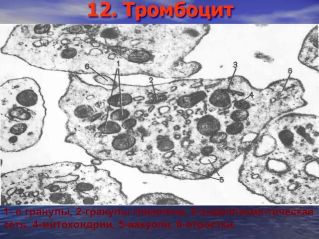 12. Тромбоцит 1- α гранулы, 2-гранулы гликогена, 3-эндоплазма-тическая сеть, 4-митохондрии, 5-вакуоли, 6-отростки.