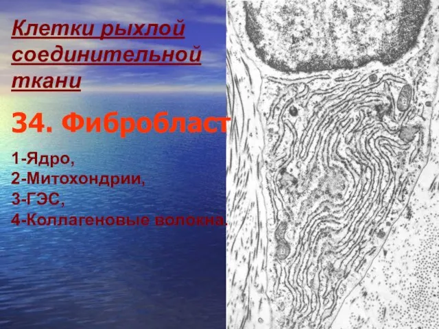 Клетки рыхлой соединительной ткани 34. Фибробласт 1-Ядро, 2-Митохондрии, 3-ГЭС, 4-Коллагеновые волокна.