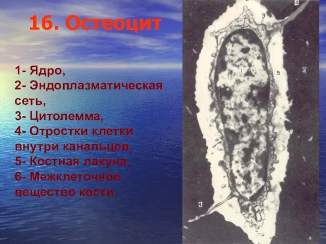 16. Остеоцит 1- Ядро, 2- Эндоплазматическая сеть, 3- Цитолемма, 4- Отростки