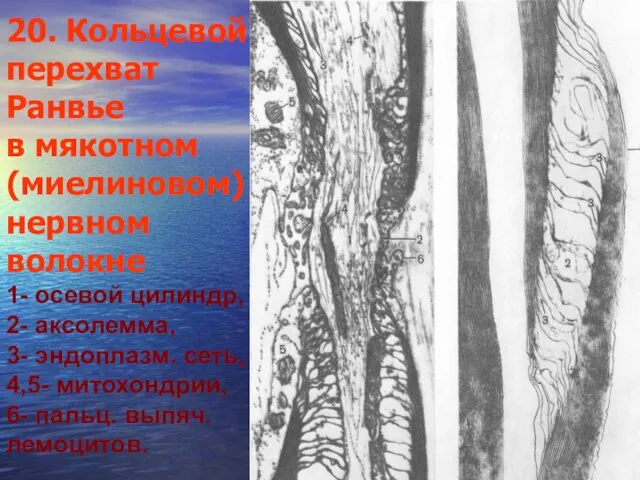 20. Кольцевой перехват Ранвье в мякотном (миелиновом) нервном волокне 1- осевой