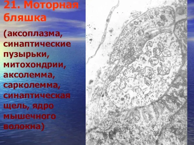 21. Моторная бляшка (аксоплазма, синаптические пузырьки, митохондрии, аксолемма, сарколемма, синаптическая щель, ядро мышечного волокна)