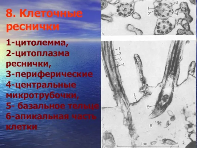 8. Клеточные реснички 1-цитолемма, 2-цитоплазма реснички, 3-периферические 4-центральные микротрубочки, 5- базальное тельце 6-апикальная часть клетки