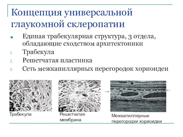 Концепция универсальной глаукомной склеропатии Единая трабекулярная структура, 3 отдела, обладающие сходством