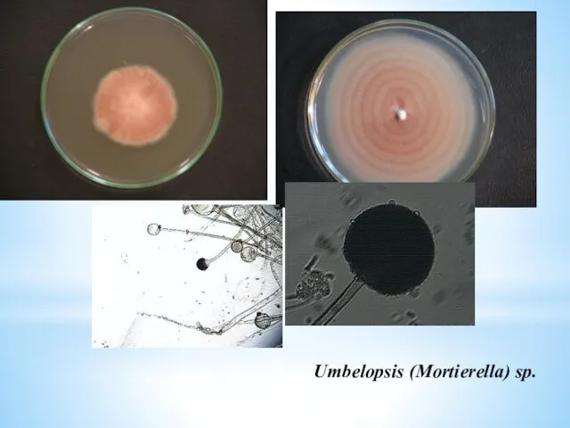 Umbelopsis (Mortierella) sp.