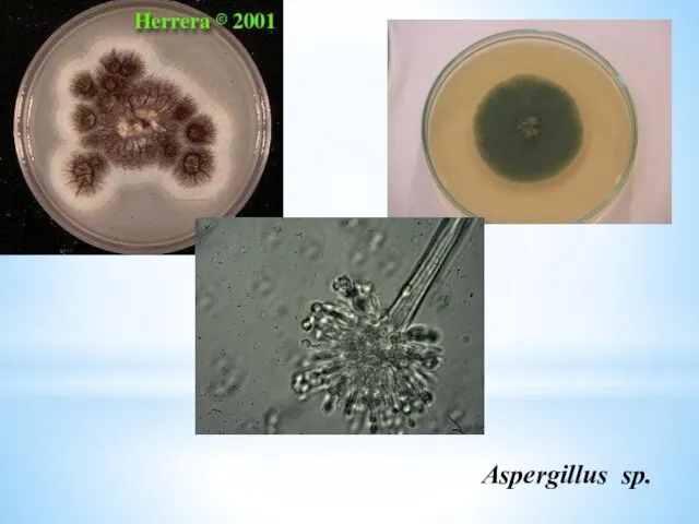 Aspergillus sp.