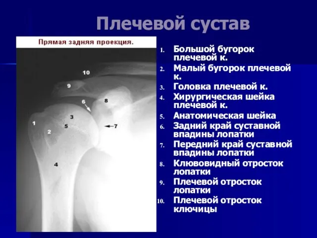 Плечевой сустав Большой бугорок плечевой к. Малый бугорок плечевой к. Головка