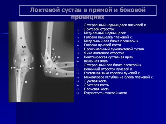 Локтевой сустав в прямой и боковой проекциях Латеральный надмыщелок плечевой к