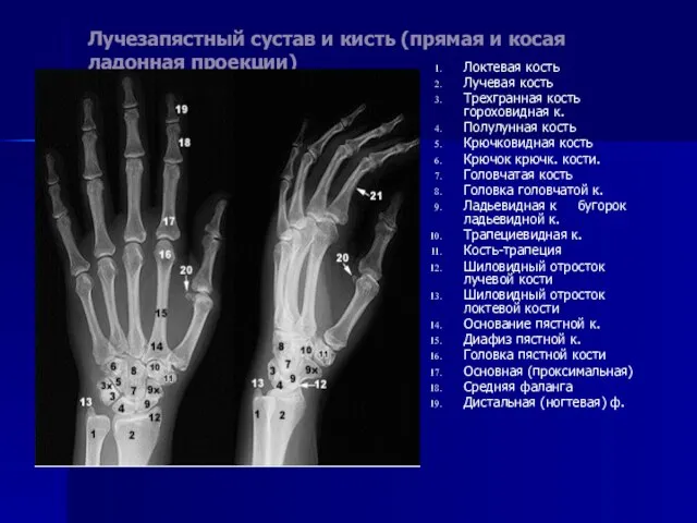 Лучезапястный сустав и кисть (прямая и косая ладонная проекции) Локтевая кость