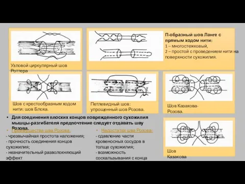 Узловой циркулярный шов Роттера П-образный шов Ланге с прямым ходом нити: