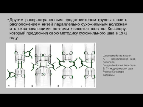 Другим распространенным представителем группы швов с расположением нитей параллельно сухожильным волокнам