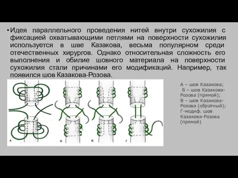 Идея параллельного проведения нитей внутри сухожилия с фиксацией охватывающими петлями на