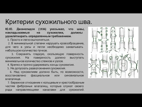 Критерии сухожильного шва. Ю.Ю. Джанелидзе (1936) указывал, что швы, накладываемые на